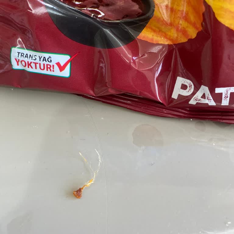 Cips Paketinden Çıkan Yabancı Madde Sağlığımı Riske Attı