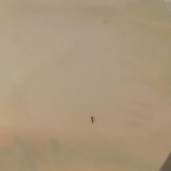 BİM'den Aldığım Yoğurtta Yabancı Madde Ve Hijyen Sorunu