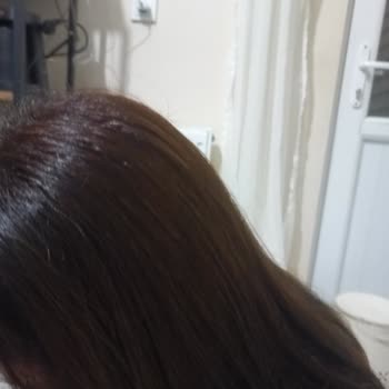 Yanlış Saç Boyası Yüzünden Saç Rengim Mahvoldu, Mağduriyetimin Giderilmesini İstiyorum