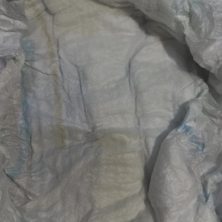 Molfix Bebek Bezinde Pamuk Eksikliği Nedeniyle Sızıntı Sorunu Yaşadım