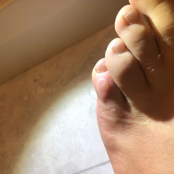 Skechers Yeni Alınan Ayakkabının Ayağıma Vurması Nedeniyle Değişim Talebi