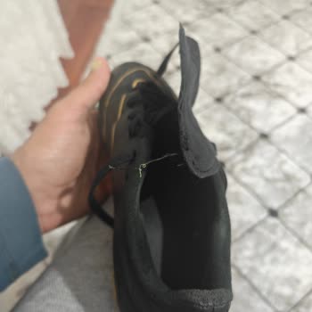 Adidas’tan Aldığım Ayakkabılar Kısa Sürede Yırtıldı, Değişim Taleplerim Reddedildi