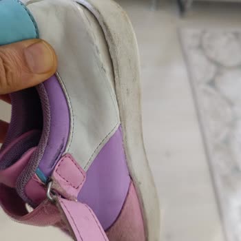 İki Ayda Kullanılamaz Hale Gelen Ayakkabı Hayal Kırıklığı