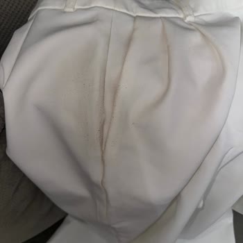 Bir Günlük Kullanımda Tüylenen Pantolon Ve Haksız İade Reddi