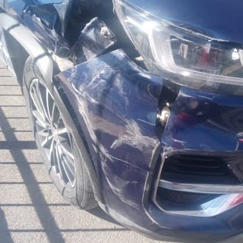 Serviste Aracıma Kaza Yapıldı, Değer Kaybı Ve Yetersiz Çözüm Teklifi