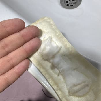 Sleepy Günlük Pedde Pul Pul Dökülme Ve Hijyen Sorunu