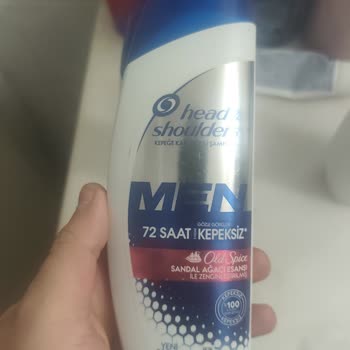 Head & Shoulders Şampuan Sonrası Yoğun Kepek Ve Saç Derisi Sorunları Yaşadık