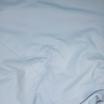 Garanti Süresi Devam Eden Üründe Tüylenme Sorununa Karşı İade Talebim Reddedildi