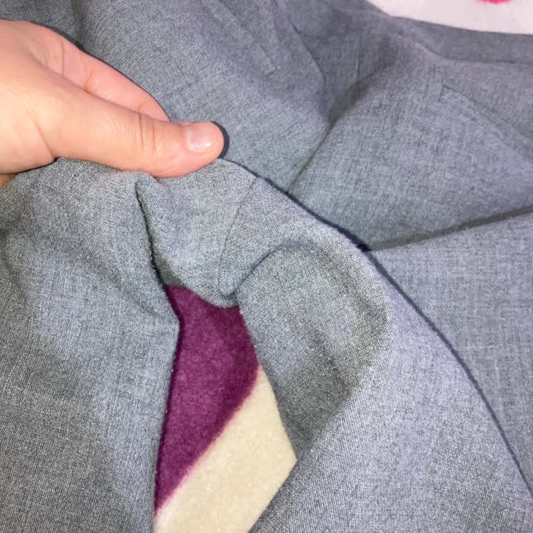 Hiç Giyilmemiş Pantolonda Tüylenme Ve Müşteri Hizmetlerinden Dönüş Alamama