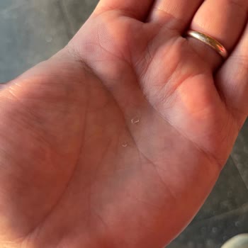 Shell Aldığım Çörekten Cam Parçası Çıktı, Sağlığım Tehlikeye Girdi