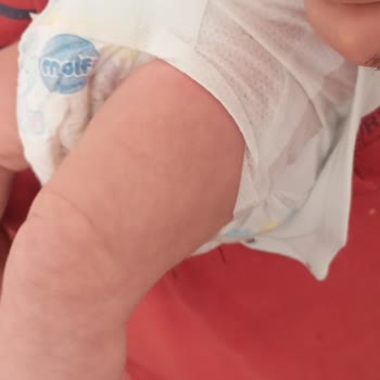 Molfix Bebek Bezleri Sıvı Sızdırıyor, Kıyafetler Sürekli Kirleniyor