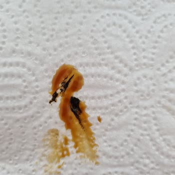 Koska Tahin Pekmezde Yabancı Maddelerle Karşılaştım Açıklama Bekliyorum