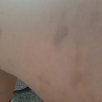 Söz Verilen Hizmetler Sağlanmadı, Seanslar Eksik Ve İlgisizlikle Karşılaştım