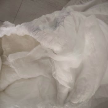 Aldığım Molfix Bebek Bezlerinde Yırtılma Ve Pişik Sorunu Yaşıyorum