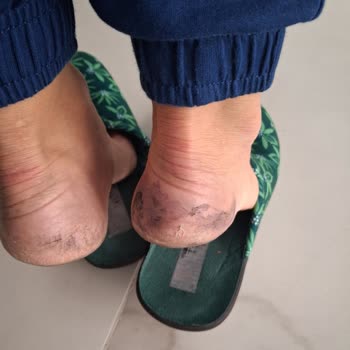 Işıkmen Ayakkabı (Balıkesir) İlk Giyişimde Ayaklarımı Boyadı