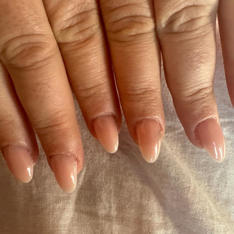 Protez Tırnak Uygulamasında Annemin Tırnakları Kötü Törpülendi Ve Çözüm Sunulmadı