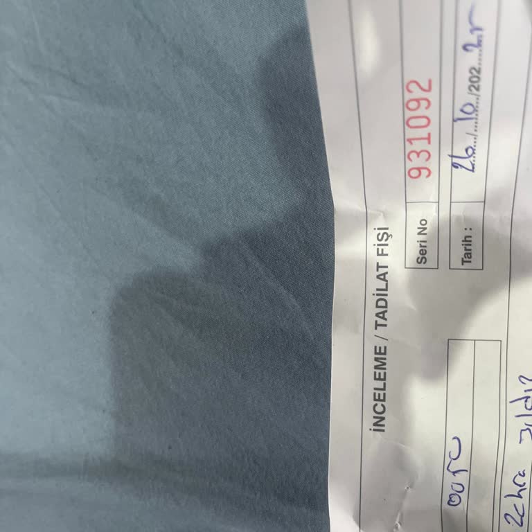 Kusurlu Ayakkabı İçin Çözüm Sunulmadı: Mağduriyetimin Giderilmesini İstiyorum