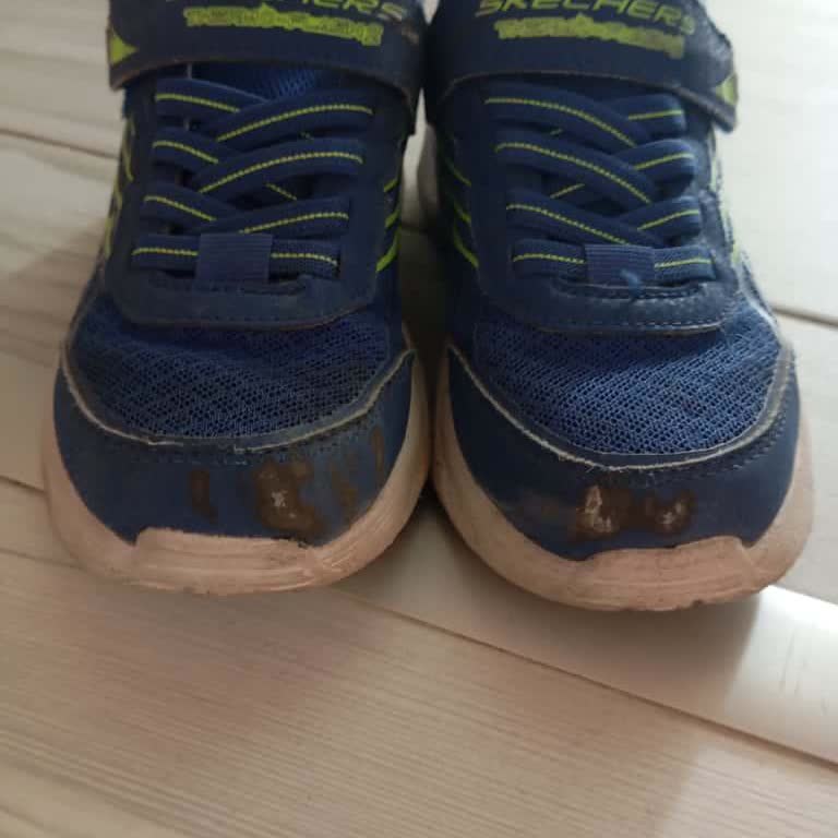 15 Günde Deforme Olan Ayakkabıya Ret Kararı Ve Garanti Mağduriyeti