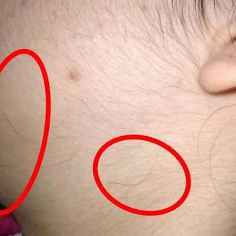 Asia Güzellik Merkezleri | İstanbul Cildimde Tahriş Oluştu ve Kıllarda Hiçbir Azalma Olmadı