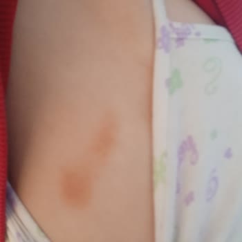 Satın Aldığım Mayonun Kısa Sürede Kullanılamaz Hale Gelmesi Ve Mağaza İlgisizliği