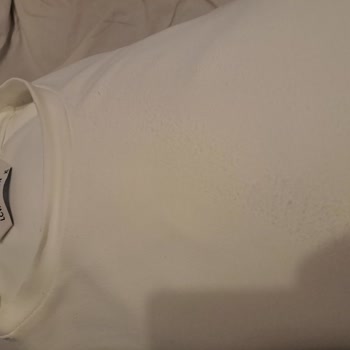 Yeni Alınan Tişörtte Hızlı Tüylenme Ve Kalite Sorunu