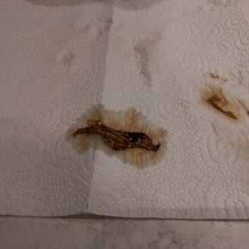 Çikolata Sosunda Yabancı Maddeyle Karşılaştım, Mağduriyetimin Giderilmesini İstiyorum