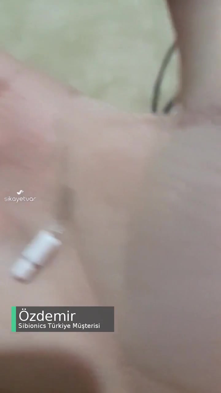Sibionics GS1 Modeli Takarken Kolumda Kırıldı! videonun kapak resmi