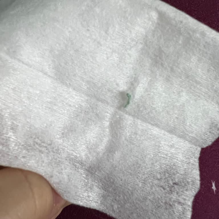 Bebek Islak Mendilinde Sert Cisimle Karşılaştım