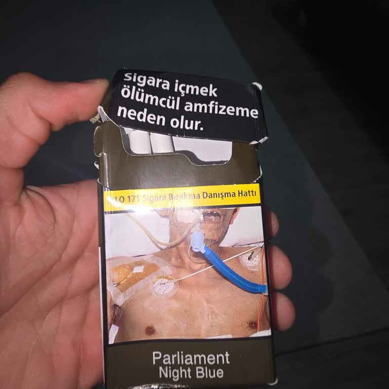 Sigara İçiminde Ateş Parçası Tişörtümü Yaktı Mağduriyet Yaşadım