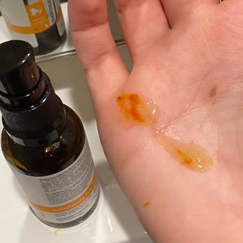 Aldığım Serumun Pompası Paslandı, İletişime Geçen Olmadı