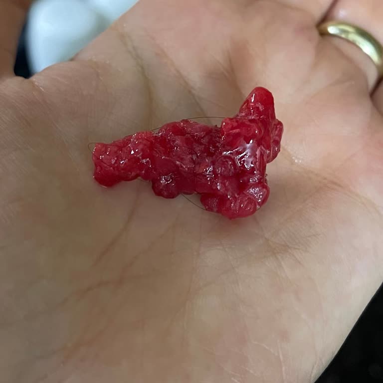 Dondurulmuş Orman Meyvelerinde Kıl Çıkması Hijyen Endişesi Yarattı