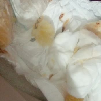 Sleepy Bebek Bezi Ciltte Tahriş Ve Kalite Sorunu Yaşattı