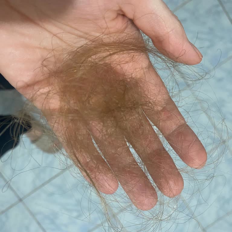 OGX Şampuan Ve Saç Kremi Saç Dökülmesine Ve Sertleşmeye Neden Oldu, İade Talebim Karşılanmadı