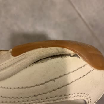 Dikiş Açılması Kullanıcı Hatası Denilerek İade Talebim Reddedildi