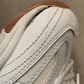 Dikiş Açılması Kullanıcı Hatası Denilerek İade Talebim Reddedildi