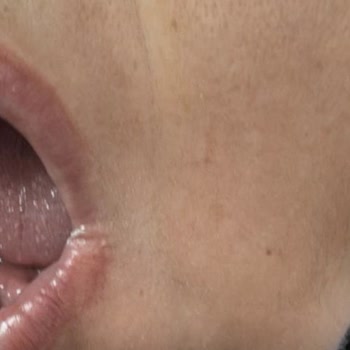 Bir Diş İçin Bitmeyen Ağrı Ve Hatalı Tedavi Süreci