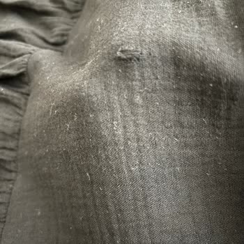 Kumaş Kalitesinden Kaynaklı Sağlık Sorunu Ve Yetersiz Müşteri Desteği