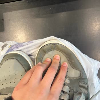 Skechers Ayakkabıda Erken Açılma ve İnceleme Sürecinde Mağduriyet