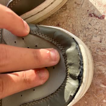 Skechers Ayakkabıda Erken Açılma ve İnceleme Sürecinde Mağduriyet