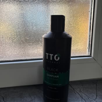 Şampuan Kepek Ve Kaşıntı Sorunumu Artırdı, Ücret İadesi Talep Ediyorum