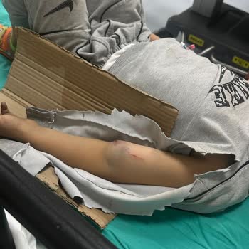 Çocuklar İçin Tehlikeli Uçurum Önlem Alınmıyor