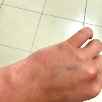 Yanlış Adli Rapor Ve İlgisiz Doktor Nedeniyle Mağduriyetim Giderilmiyor