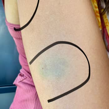 Yanlış Adli Rapor Ve İlgisiz Doktor Nedeniyle Mağduriyetim Giderilmiyor