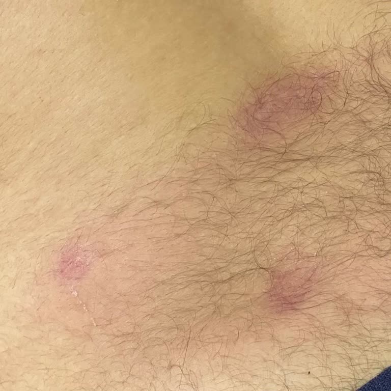 Şanlı Yakı Sırtımı Yaktı