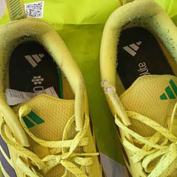 Adidas Ayakkabıda Erken Deformasyon Ve Garanti Reddi