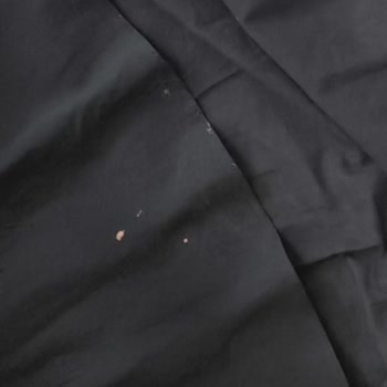 A101 Mağazasında Çamaşır Suyu Nedeniyle Düşme ve Maddi Zarar: Yardım Edilmedi