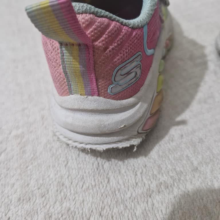Skechers Ayakkabıda Kısa Sürede Deformasyon Ve Yetersiz Müşteri Hizmeti