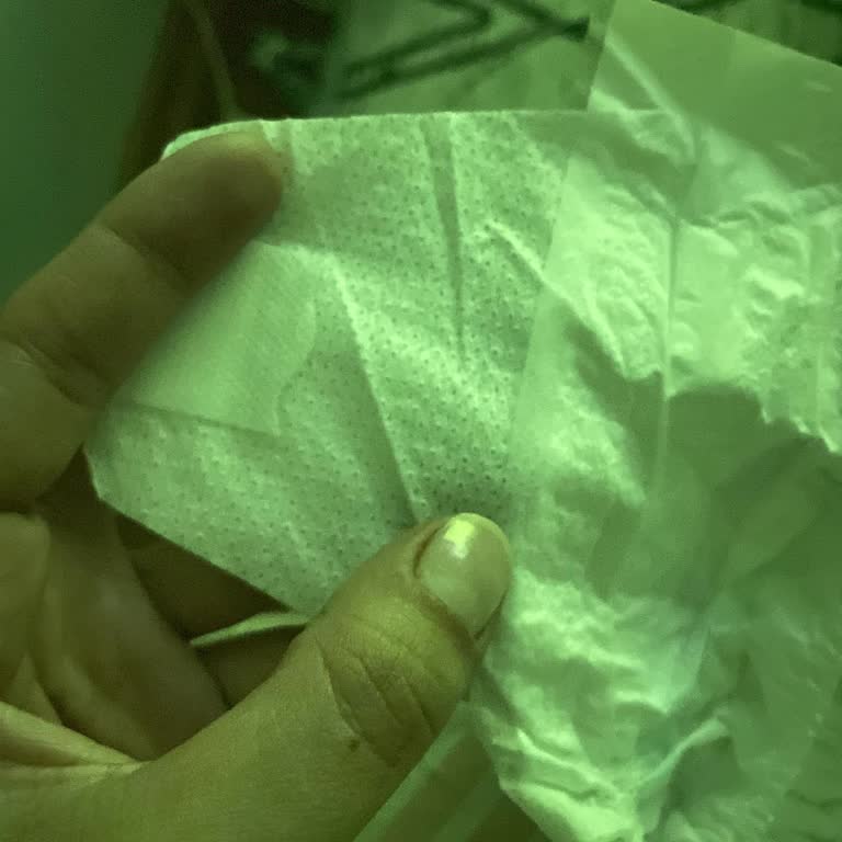 Molfix 5 Numara Bebek Bezinde Yapışkanlı Bölüm Sürekli Kopuyor, Ürün Kullanılamaz Hale Geldi