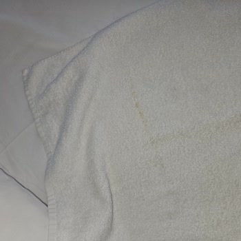 Hijyen Sorunu Ve Eksik İade Nedeniyle Mağduriyet Yaşadım