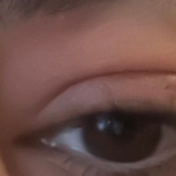 Maruderm Aynı Lot Numaralı Üründe Farklı Koku Sorunu